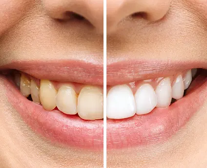 image-comparison image-comparison