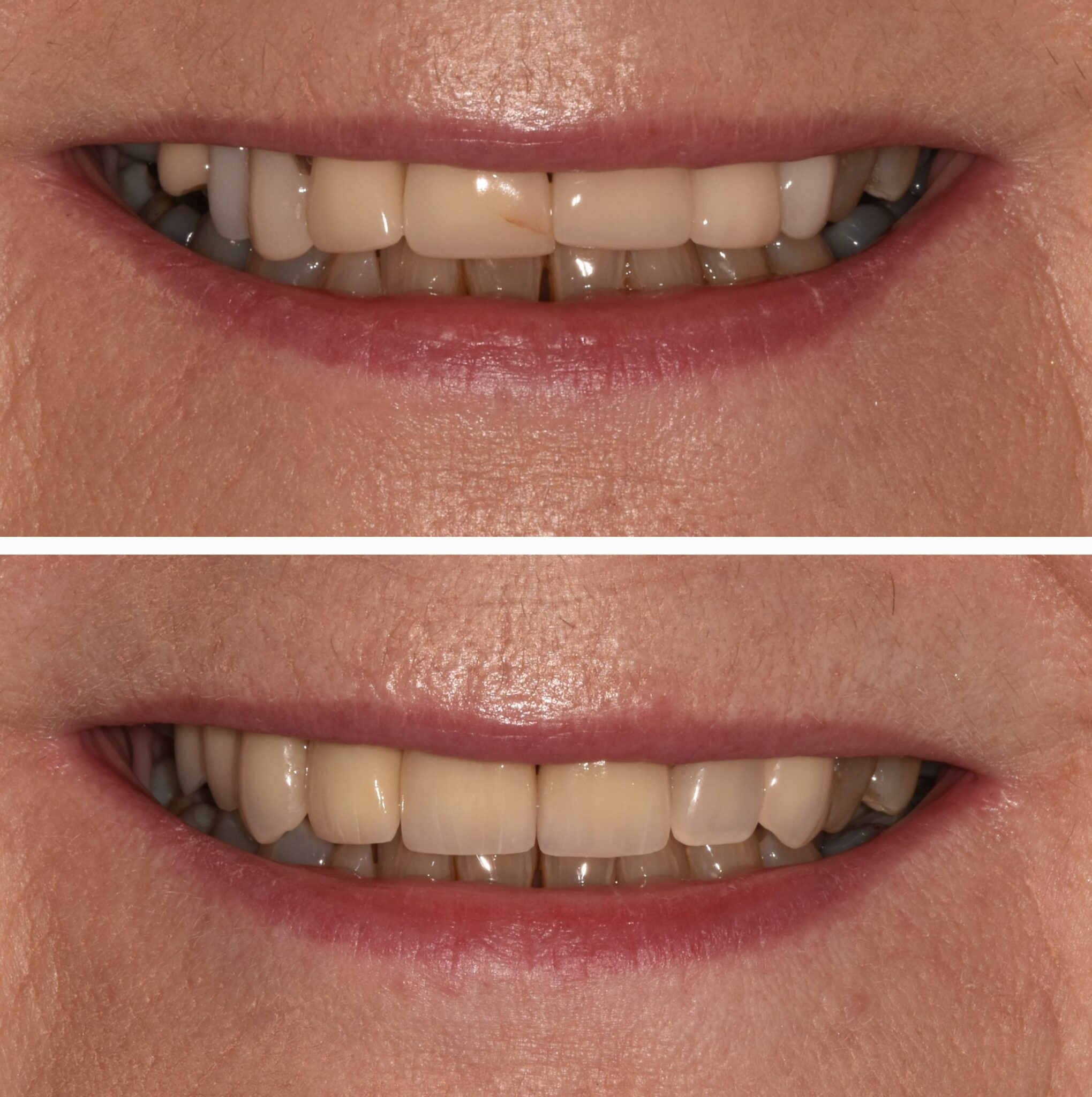 20240915_121111-2039×2048 20240915_121111-2039x2048