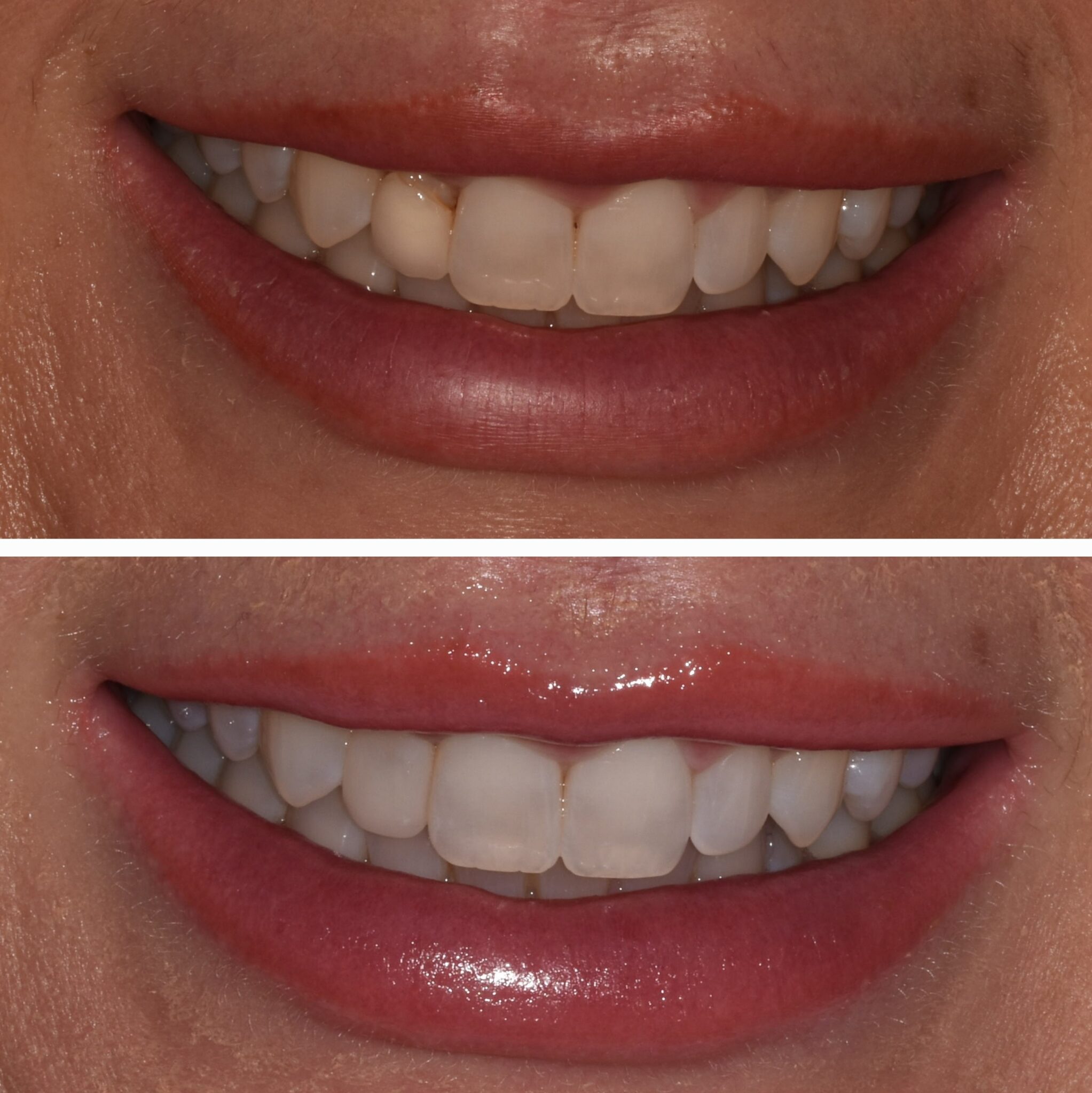 20240915_125936-1-2045×2048 20240915_125936-1-2045x2048