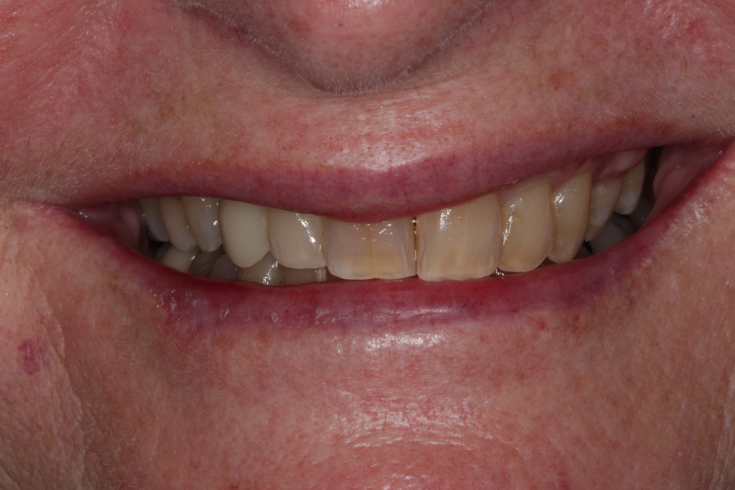 After-smiling-scaled