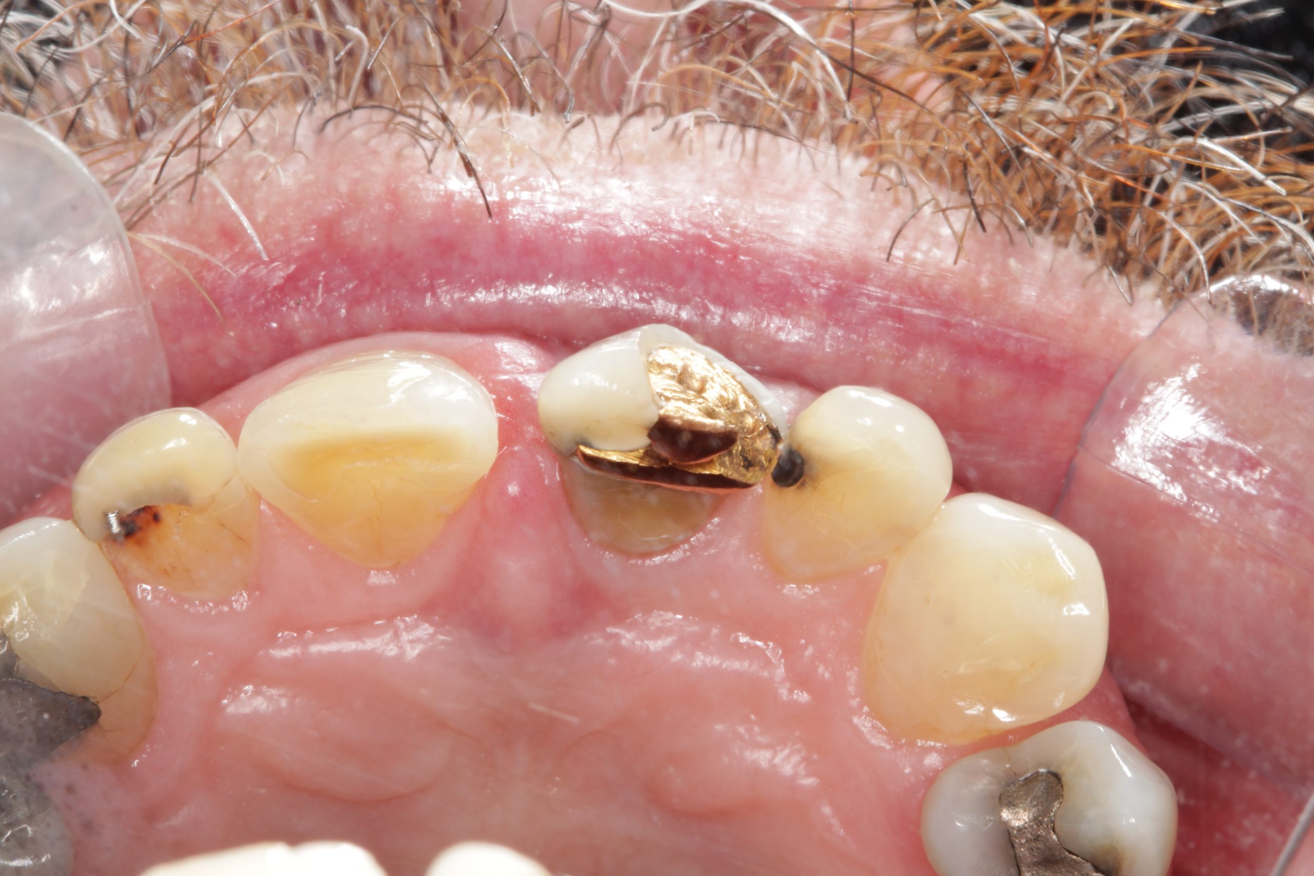 Before-Occlusal-scaled Before-Occlusal-scaled