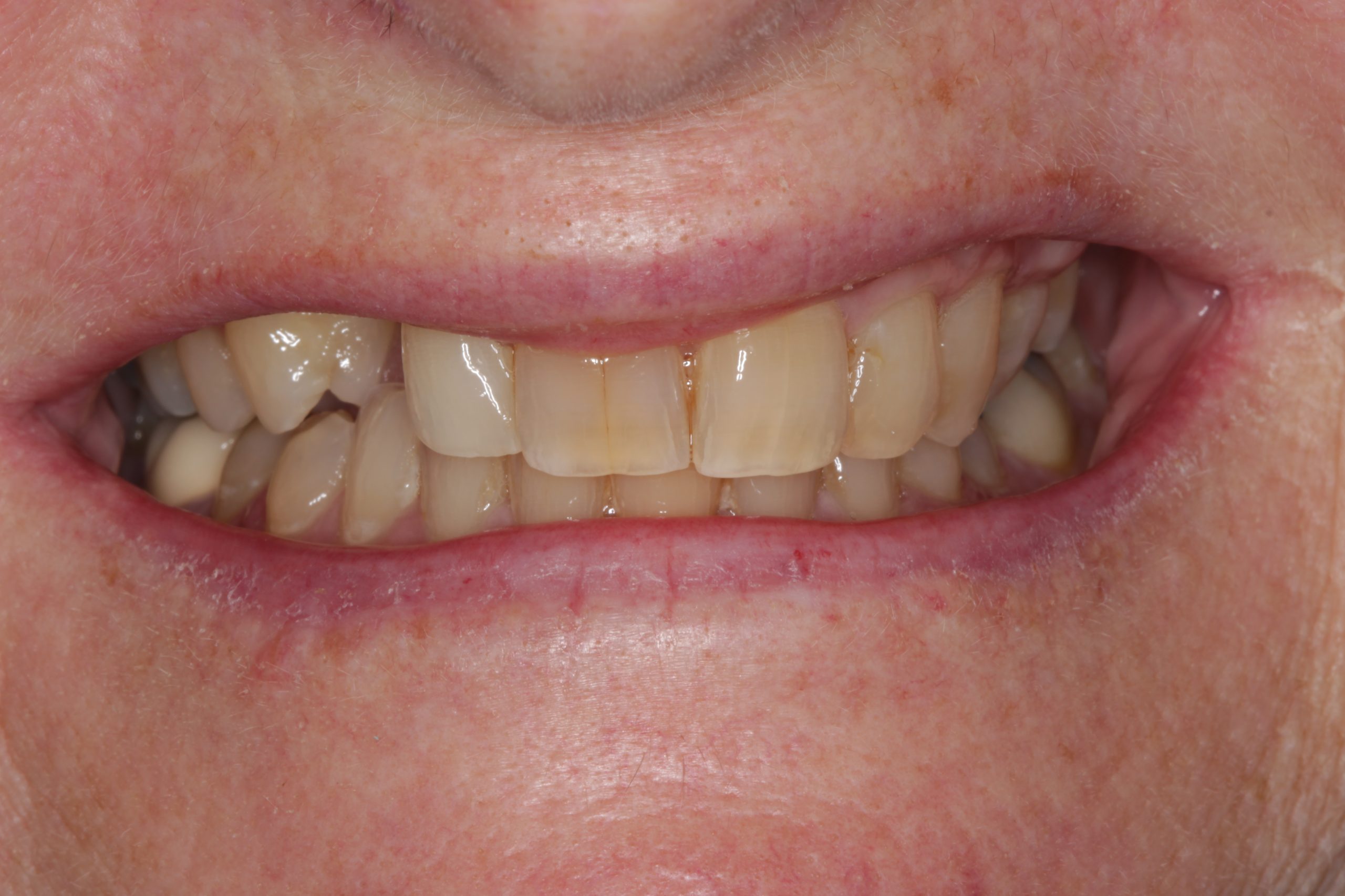 Before-Smiling-scaled Before-Smiling-scaled