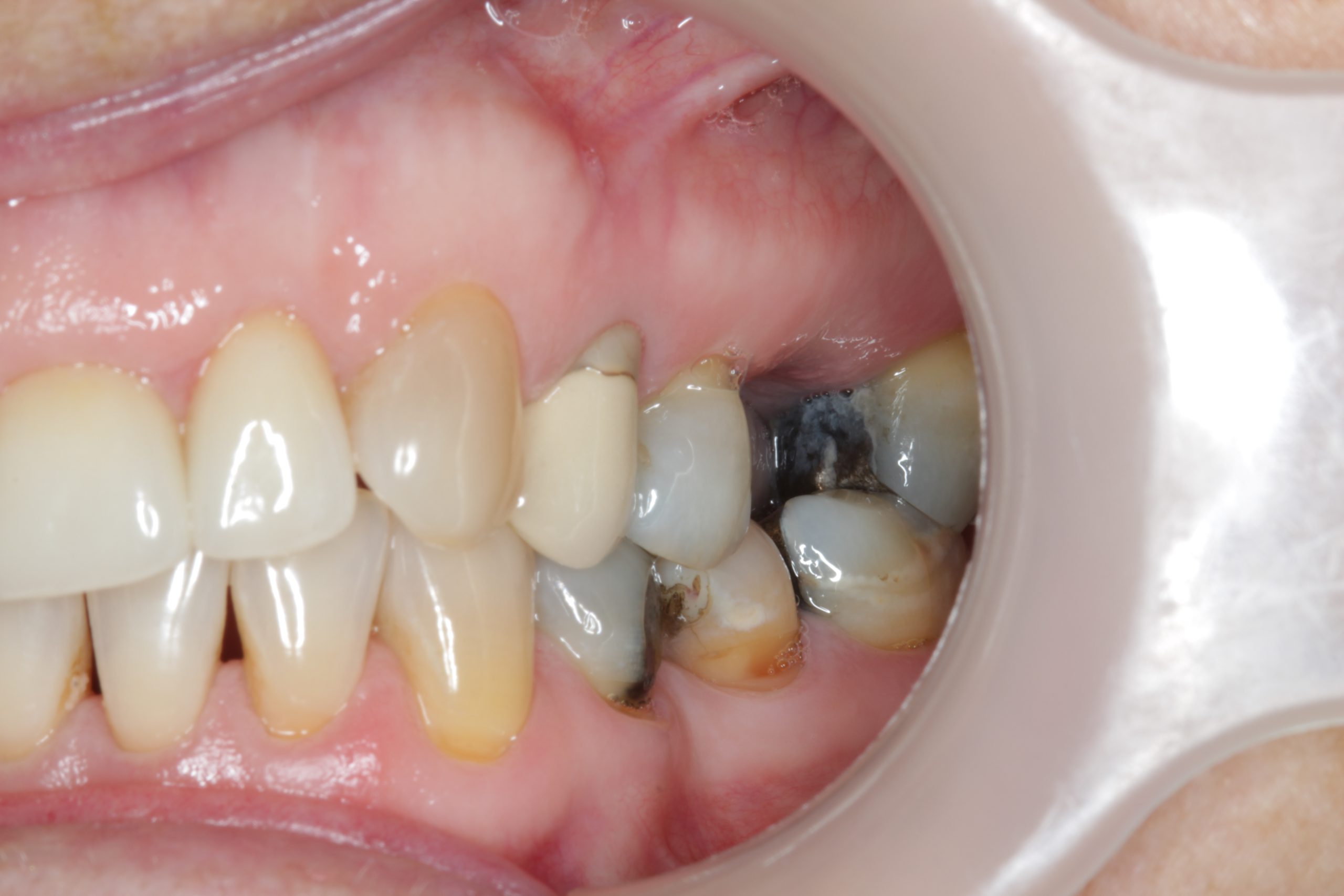 side-view-before-scaled side-view-before-scaled